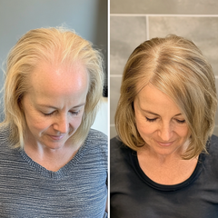 Halave™ Crown Toppers